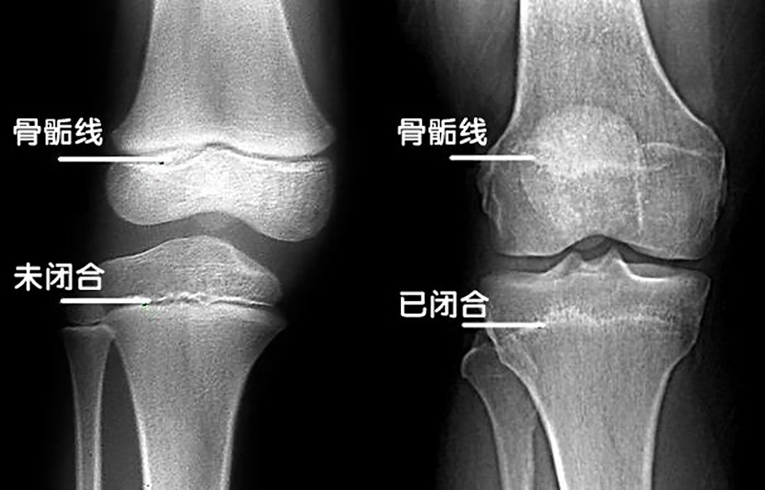 成人真的可以再调理长高吗,成年人可以通过身体塑形长高吗