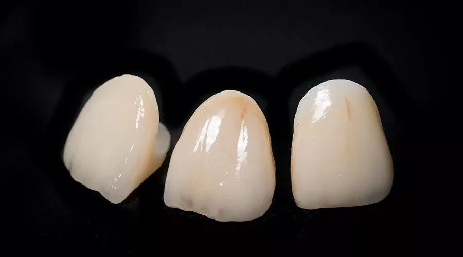 牙医的根管治疗有什么套路,为什么根管治疗后一定要做牙套