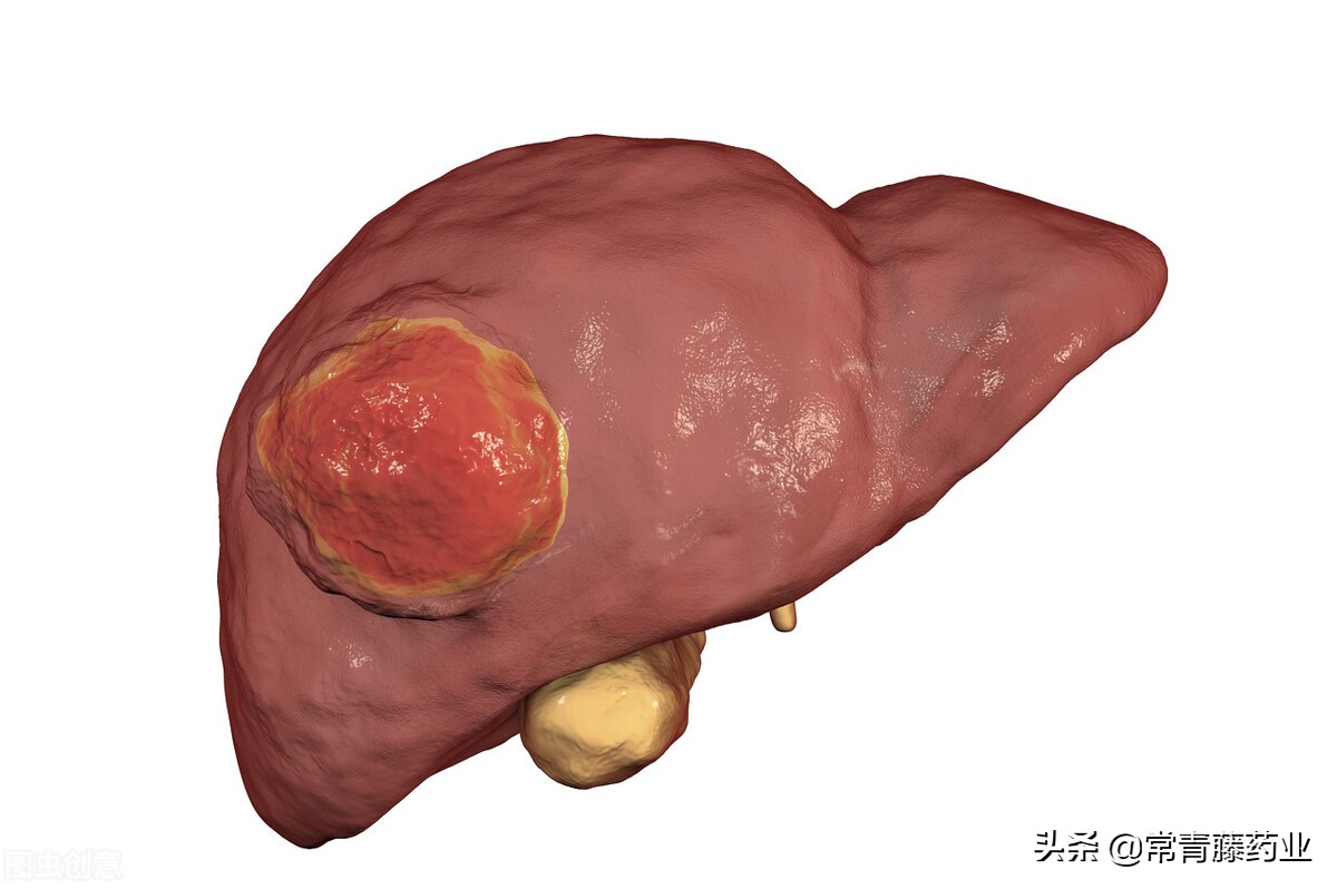 甲胎蛋白afp属于什么检查,甲胎蛋白afp是检查什么病