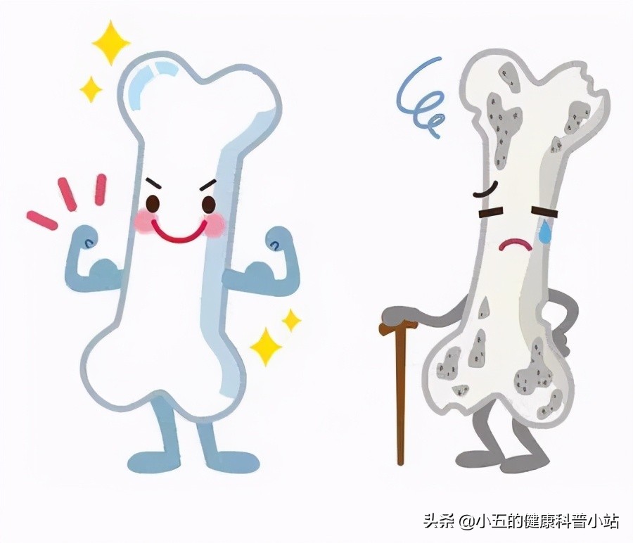 长期吃钙片怎么还是骨质疏松了呢,常年吃钙片的好与坏