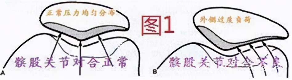 好久不活动一锻炼就膝盖疼,膝盖运动就疼休息就好