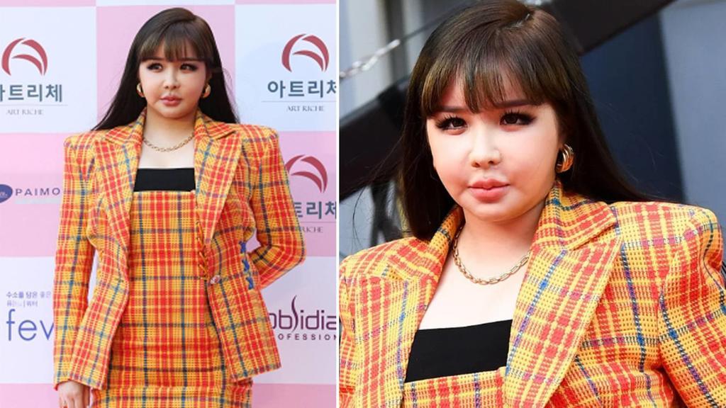 人间芭比近况,人间芭比整容成功了吗