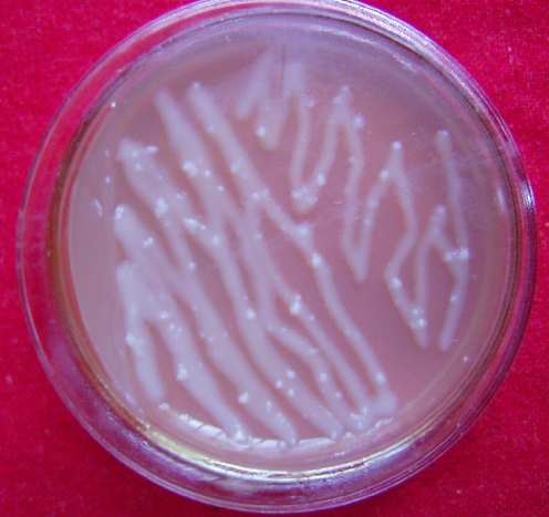 什么是转基因植物,植物转基因有什么是转不出来的