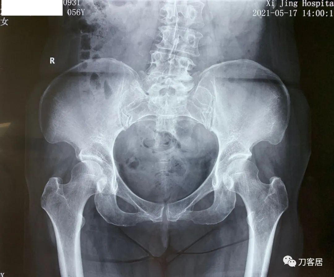 我的门诊病历,我的门诊