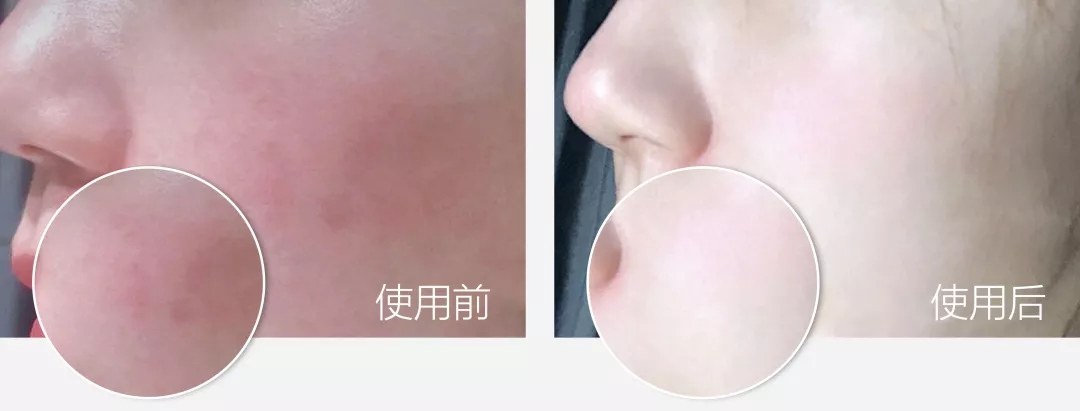 蔡依林的腿值多少钱,蔡依林最迷人的鞋