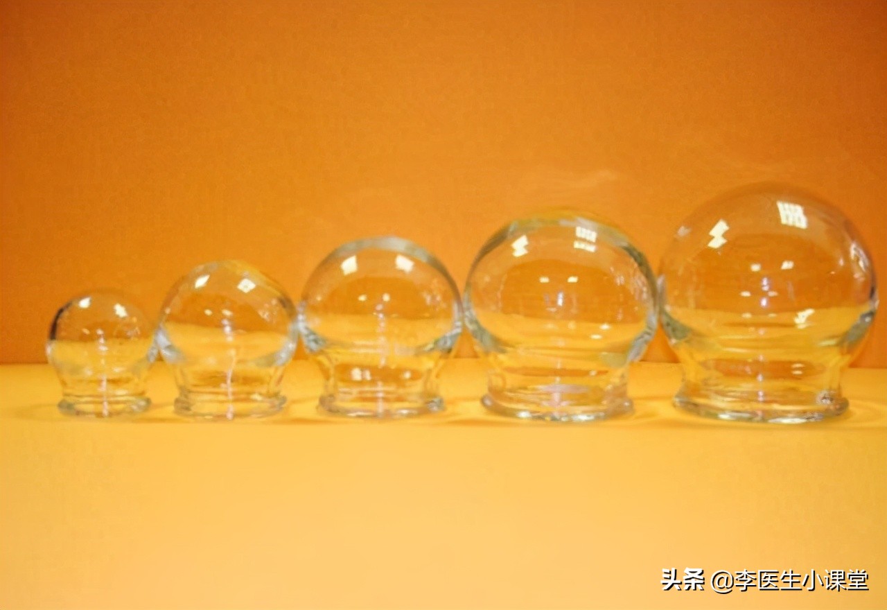 拔罐后罐印上有白点怎么回事,拔罐出现淤青是怎么回事