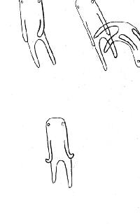 湿疹麻疹的区别,湿疹荨麻疹最简单的自愈方法