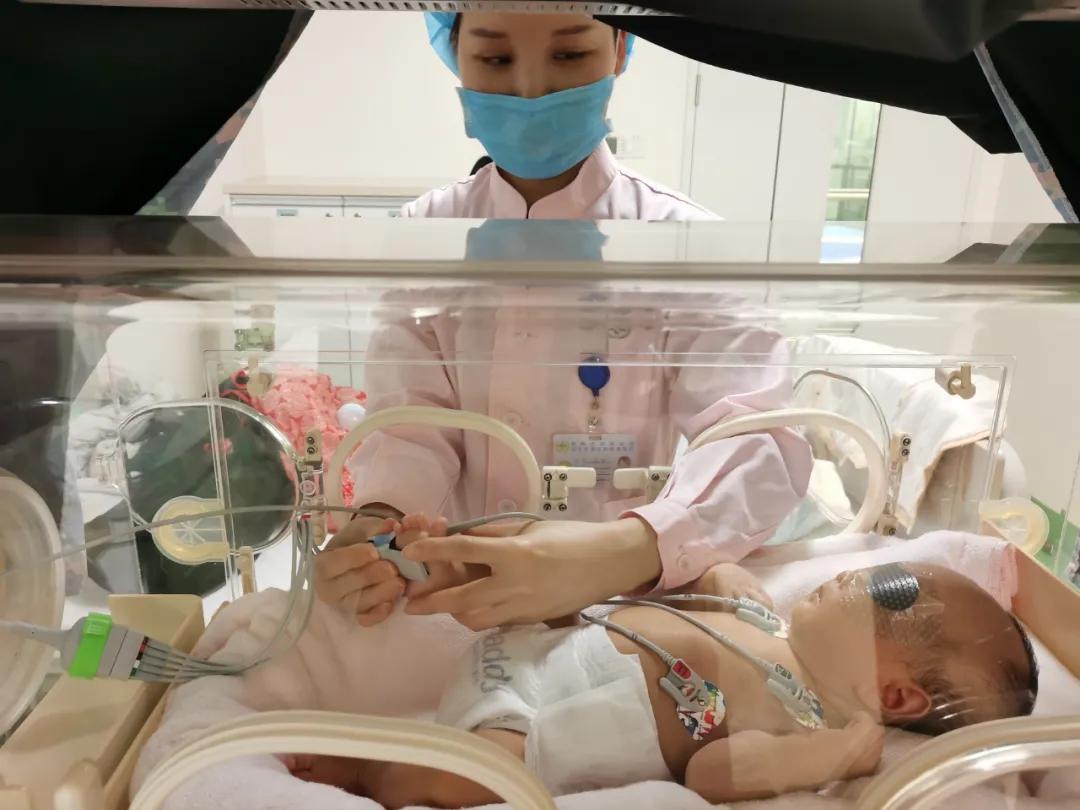 宝宝上午黄疸高下午减轻,黄疸早上高下午降