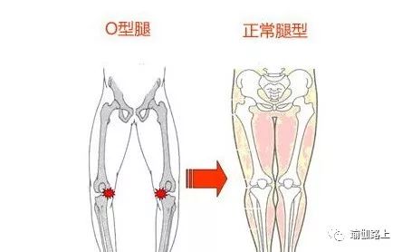 如何用瑜伽矫正x型腿,瑜伽式矫正o型腿最有效的动作