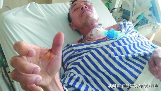 认识破伤风手抄报,你知道破伤风有多可怕吗