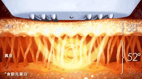 美容针变“毒针”，19岁女孩被毁容，医生：打针有风险跟风需谨慎