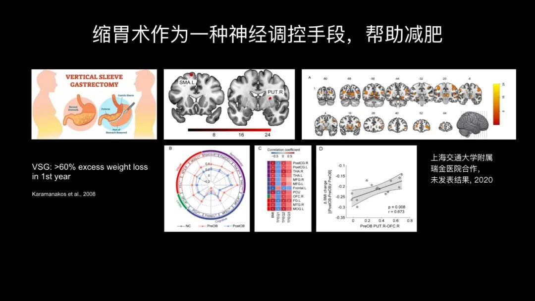 五个能控制你大脑的可怕实验,电击治疗精神分裂症会失忆吗