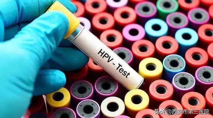 hpv健康科普这几类人你要多注意,hpv检测女性