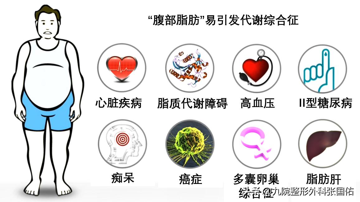 肥胖型大肚子的表现,肥胖大肚子是怎么引起的