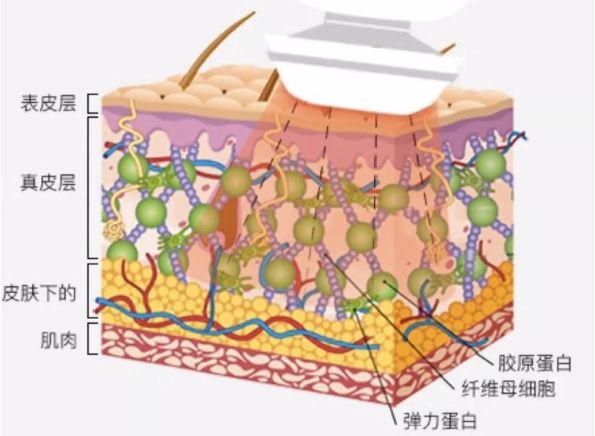 雅萌到底该怎么选,雅萌顶配值得入手吗