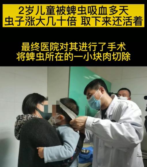 孩子被蚊虫咬了怎么办最有效,儿童被蚊虫叮咬可能引发的疾病