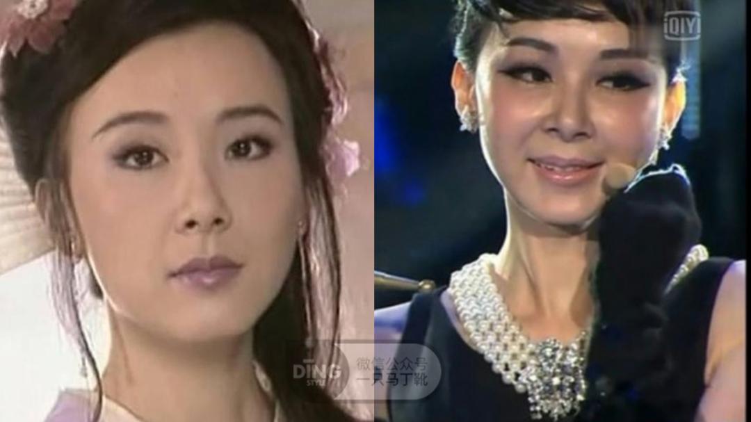 整容最成功的美人,整容最成功的13个人