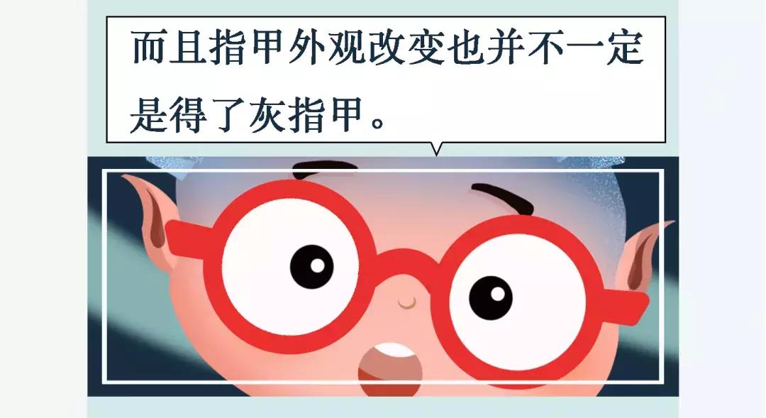 得了灰指甲一个传染俩偏方,得了灰指甲一个传染俩的药是什么