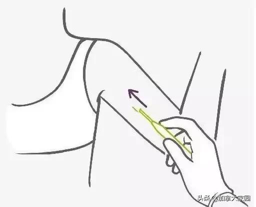 女性避孕贴片新型,美国避孕贴效果怎么样