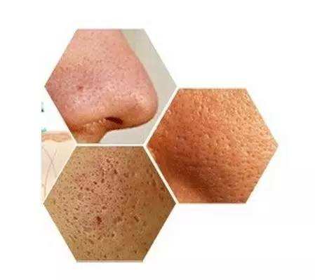 毛孔分析,毛孔问题解决方法视频