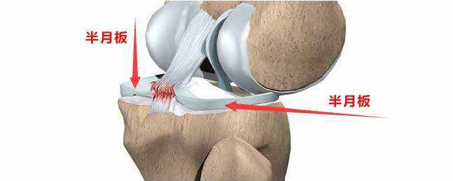 爬楼梯膝盖吃力怎么回事,爬楼梯太多膝盖疼怎么缓解