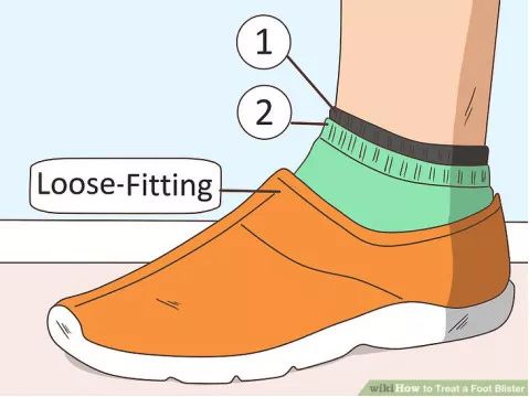 跑步脚上起水泡怎么处理好得快,脚跑步起水泡怎么处理好得快