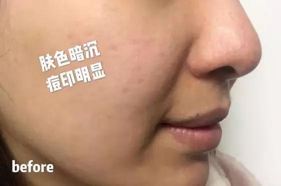 美白祛黄提亮肤色泡水喝,每天喝一杯可以美白淡斑清热解毒