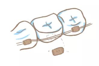 正畸疫情复诊,口腔科应对新冠疫情的控制措施