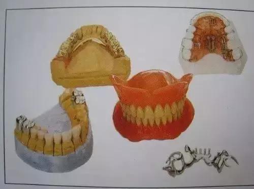 如何挑选烤瓷牙材料,怎样选择适合你的烤瓷牙