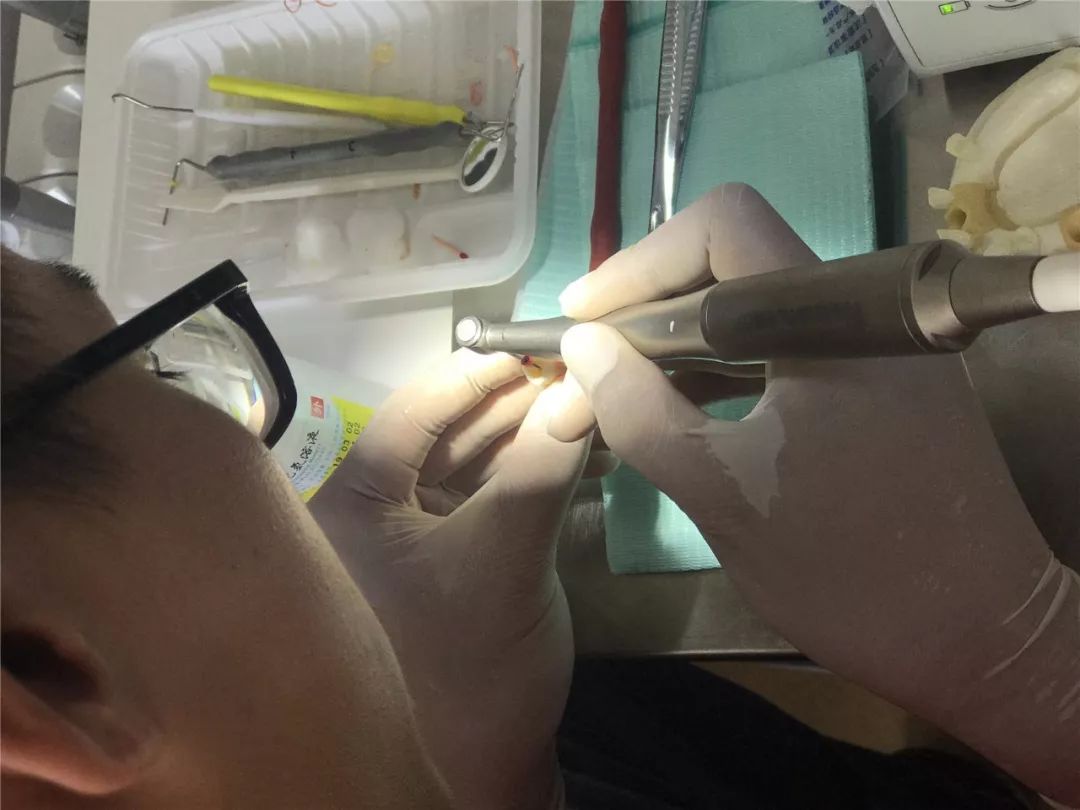 青岛西海岸中心医院根管治疗,青岛西海岸骨干培训班