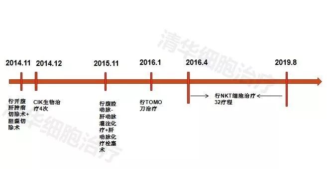 硼中子治疗癌症复发几率多高,癌症术后复发几率