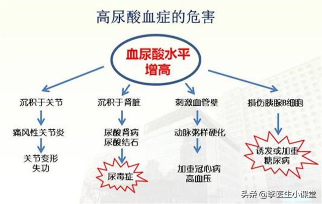 痛风发作怎么办一招教你缓解痛风,痛风发作疼痛难耐三招快速缓解