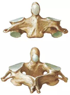 颈椎腰椎疾病ct及mri诊断,腰椎ct可以发现肠部病变吗