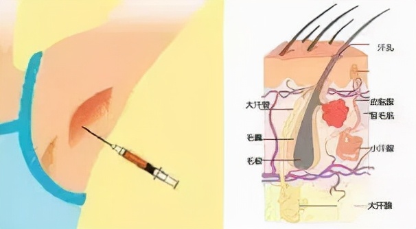 如何根治狐臭6妙招助你去除狐臭,如何根治狐臭6妙招助你祛除狐臭