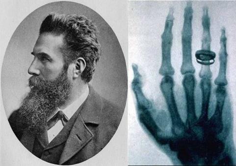 1900年，欧洲人用X光试鞋、脱毛甚至选美，使用者最后怎么样了？