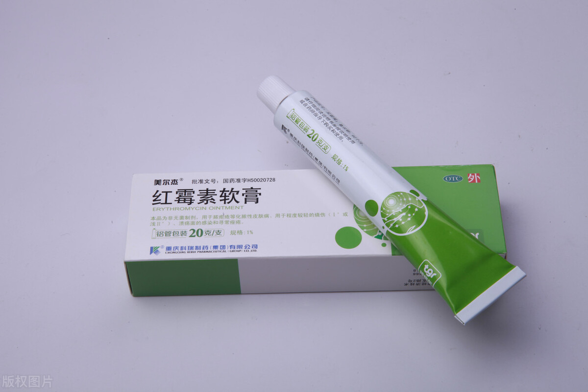 几块钱的红霉素软膏,生活中4个用处很实用,提醒这3种情况不可用