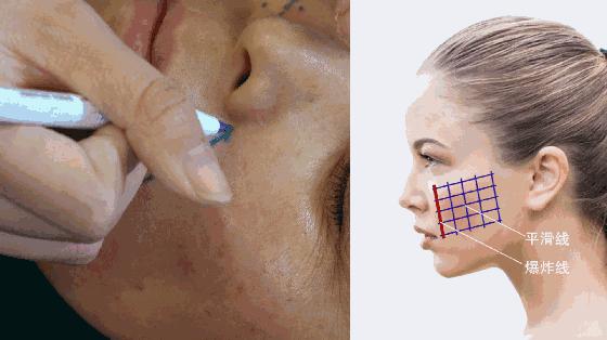 三招改善法令纹,一招就可以把你的法令纹淡下去