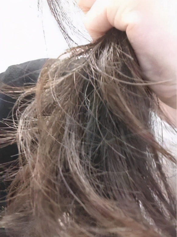 头发变黄后变白发什么原因,不知不觉你却白了头