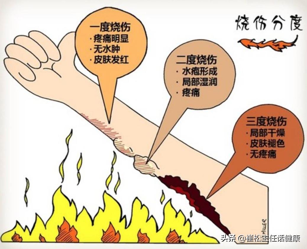 疫情有腹痛症状吗,有没有疫情期间肚子疼