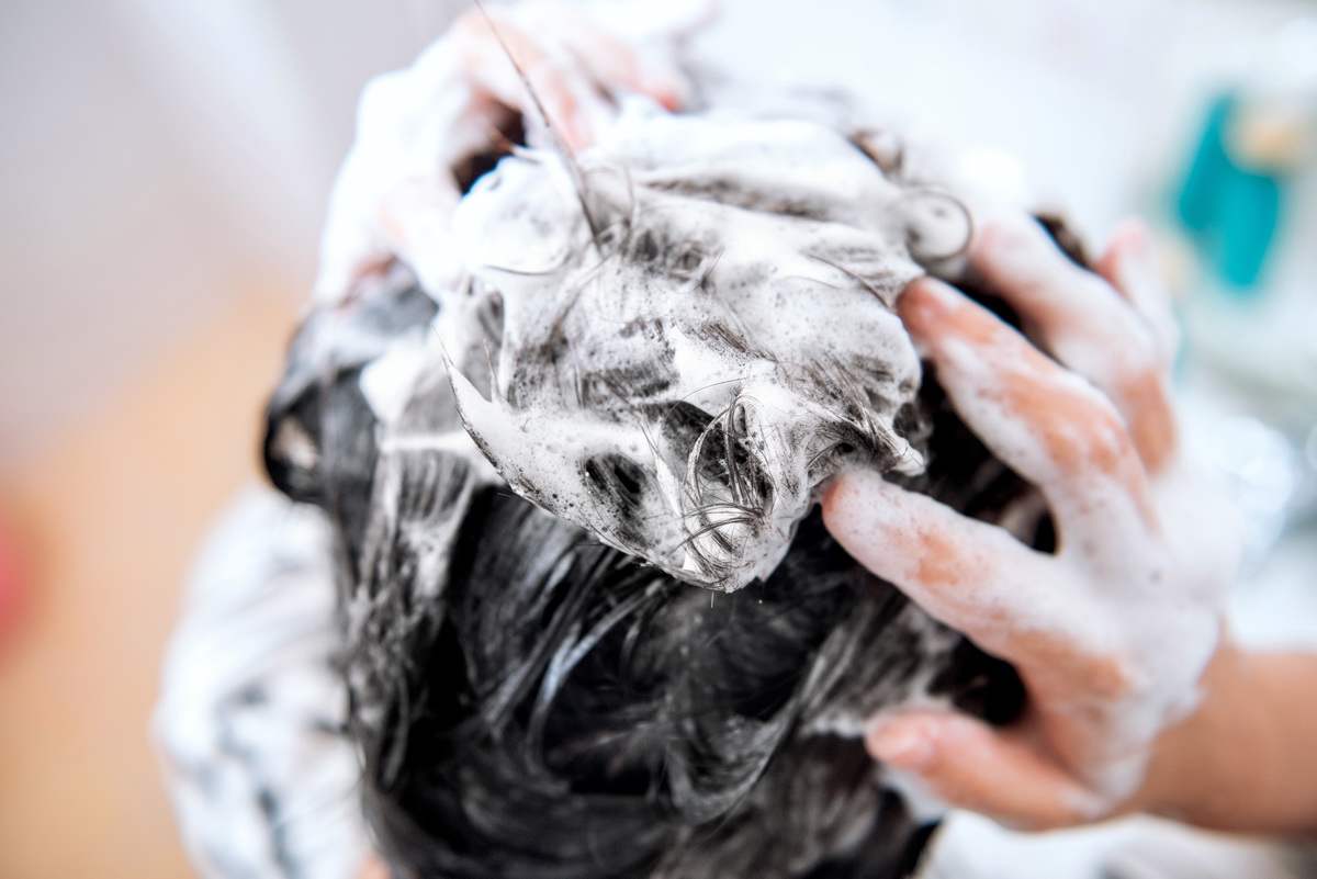 头皮螨虫清理,头皮出油屑多怎么去除