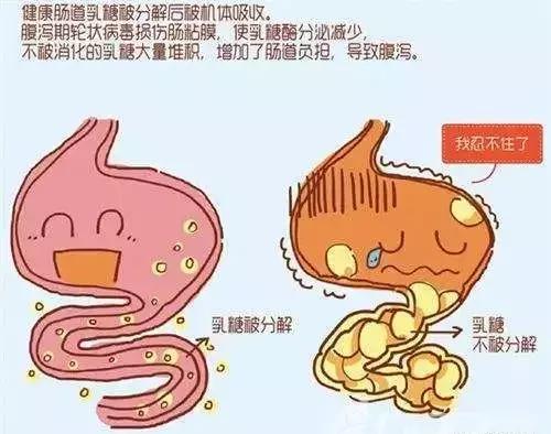宝宝腹泻大便有黏液怎么回事,粪便为稀水便或水样便无粘液脓血