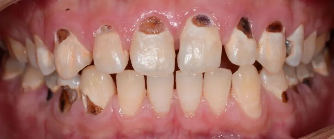 口腔牙医感言,牙医从业感悟