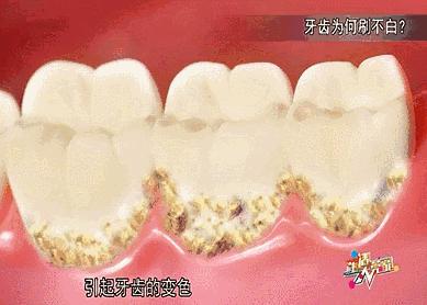 真正能把牙齿刷白的牙膏测评,进口去牙渍牙垢牙黄的牙膏第一名