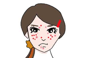 修丽可哪一款适合痘印,修丽可哪款精华祛痘印闭口好用