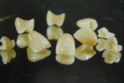 假牙最便宜一颗多少钱,假牙最贵