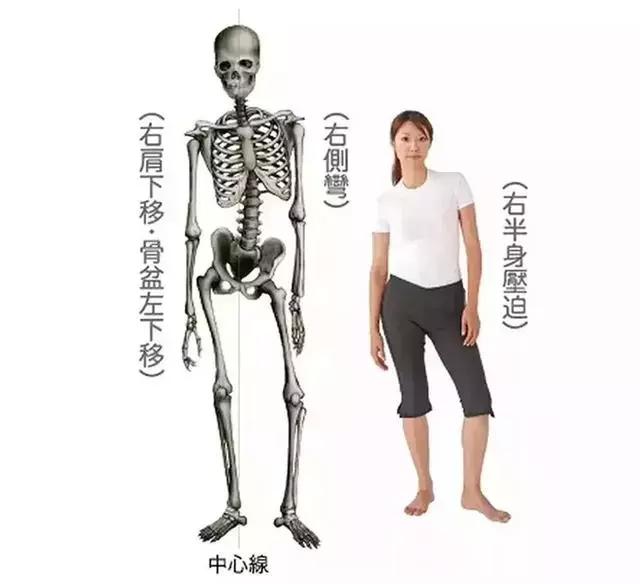 产后子宫脱垂用做盆底肌修复么,产妇盆底肌脱垂用什么办法修复