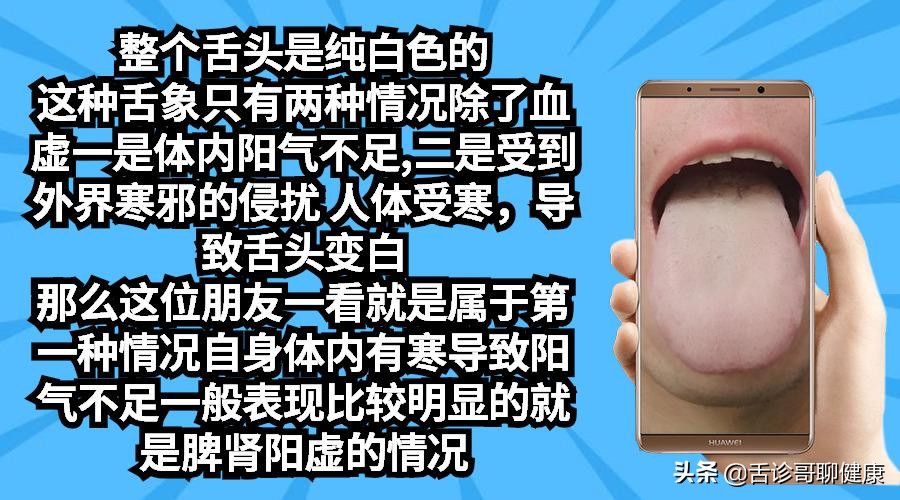 尿路结石口干舌燥恶心,尿路结石导致恶心呕吐不尿尿