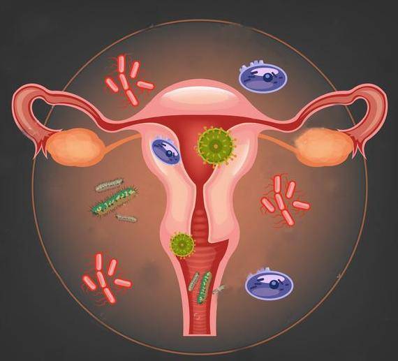 太爱干净，也会得阴道炎？看完你还敢那么干净吗？