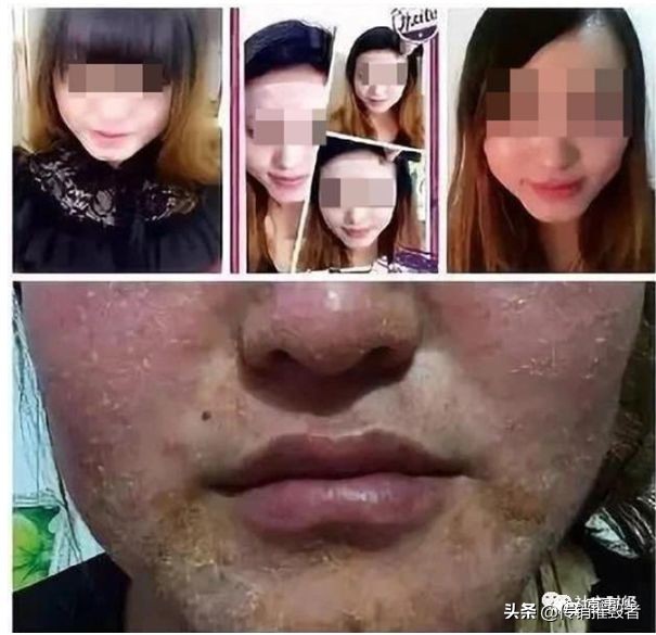 权健和tst,tst和权健