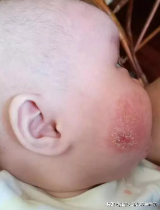 敏感肌保湿cerave,cerave敏感修复乳液